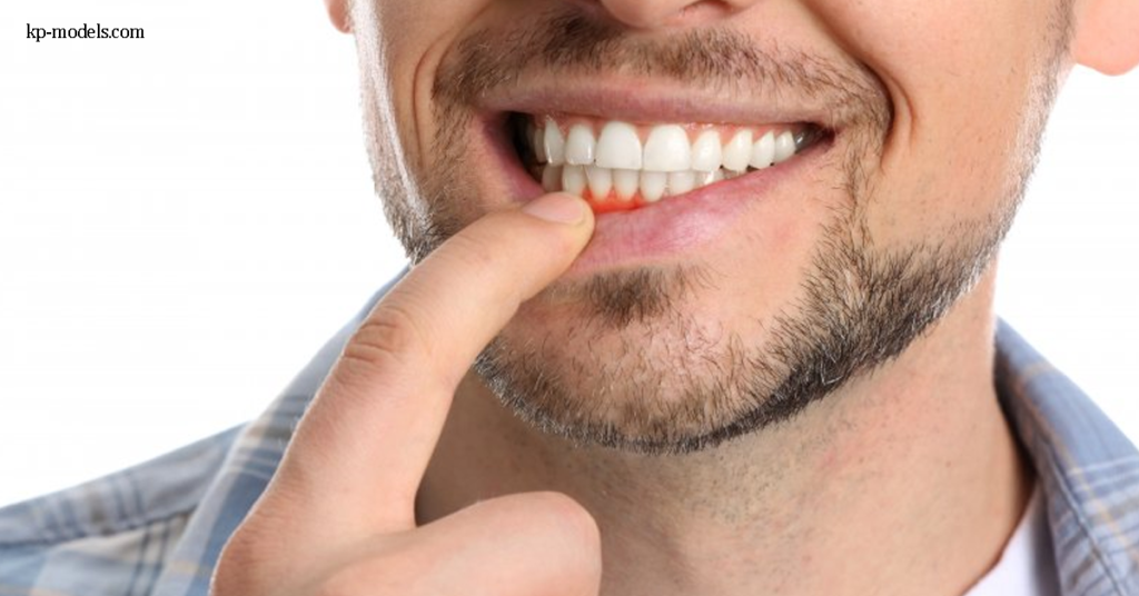5 วิตามิน ที่จำเป็นสำหรับสุขภาพฟันและเหงือก การดูแลฟันและเหงือกของคุณเป็นมากกว่าการแปรงฟันและใช้ไหมขัดฟัน นอกจากนี้